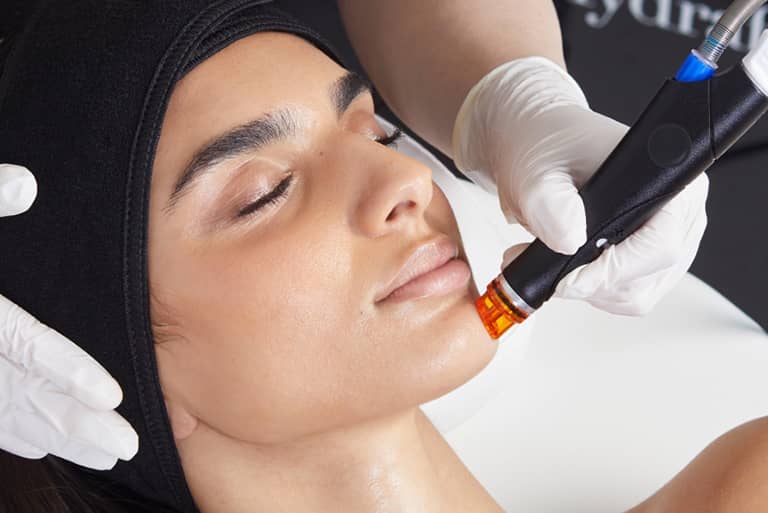 What to Expect Before Hydrafacial