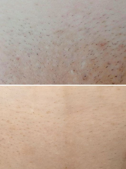 Bikini result