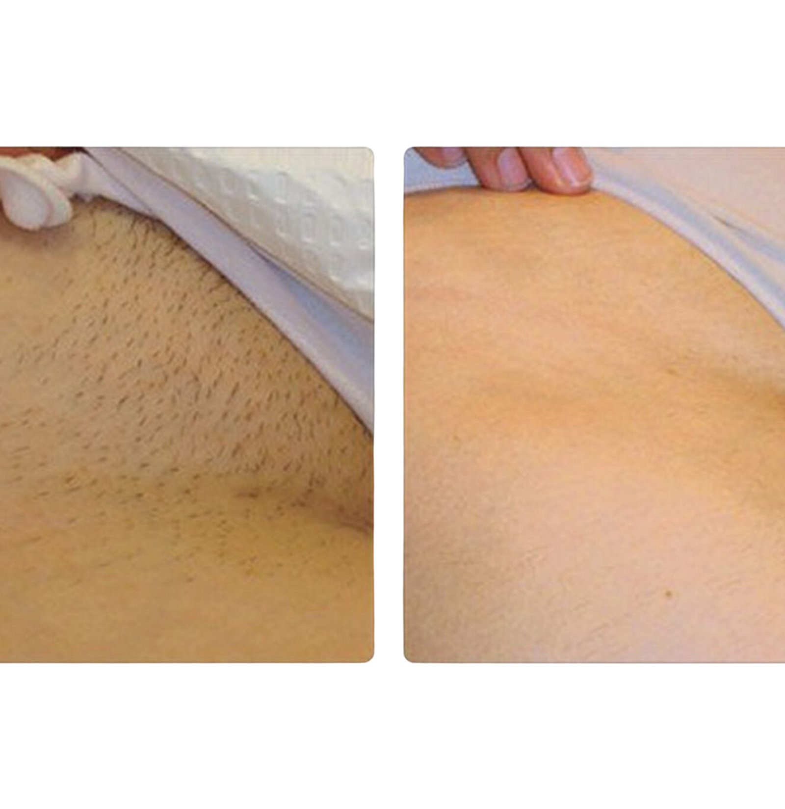 Bikini result