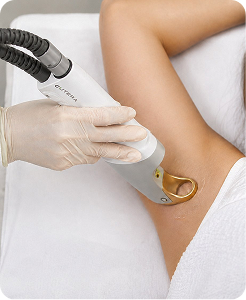 Underarms First Treatment $1