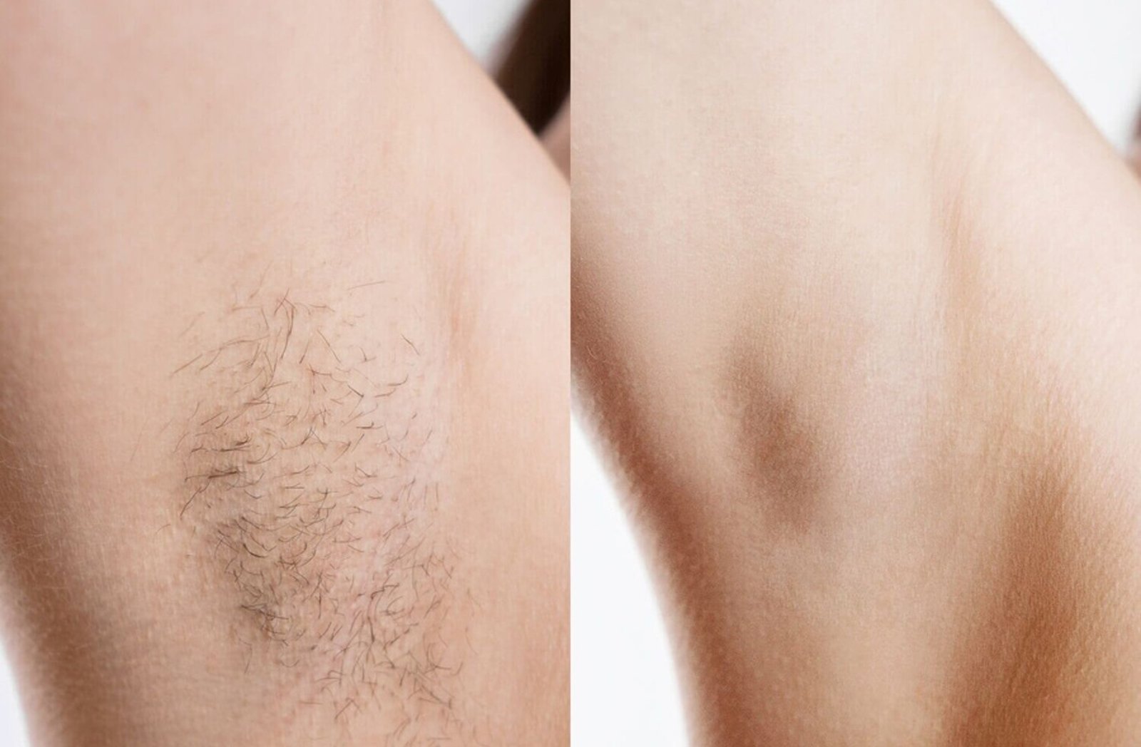 Underarm result