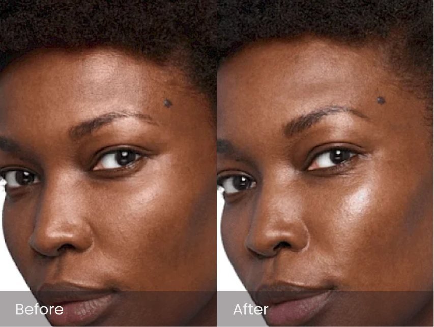 Skinvive by Juvederm