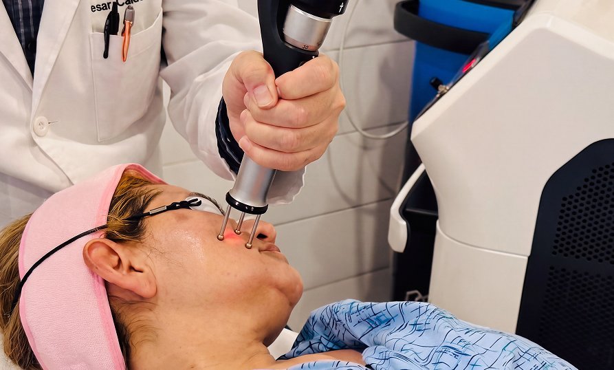 Laser Skin Resurfacing