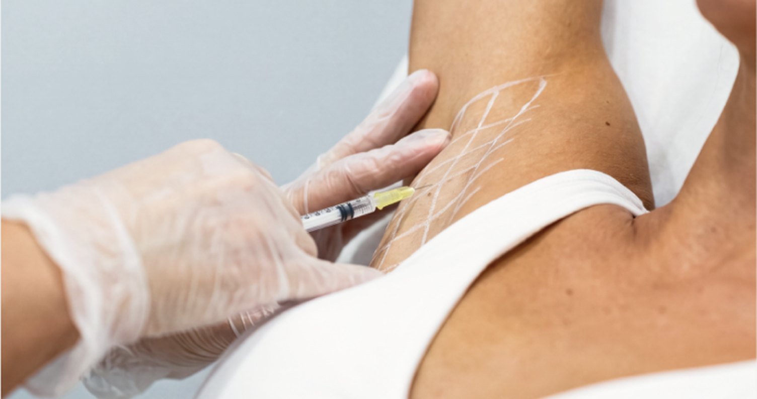 Injectables Sweating