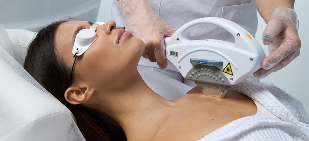 IPL Photo Facial