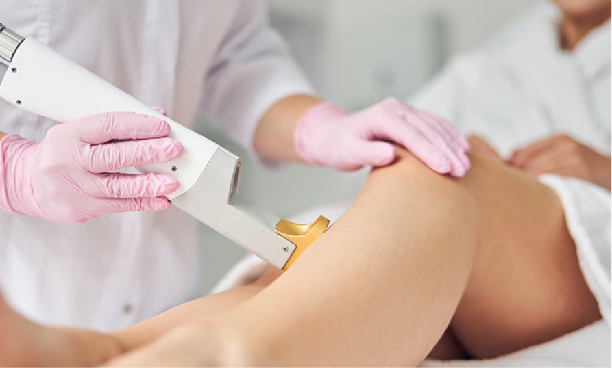 Laser Hair Removal