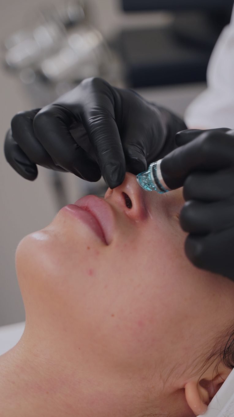 HydraFacial