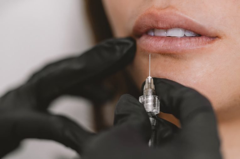 Injectables Lips
