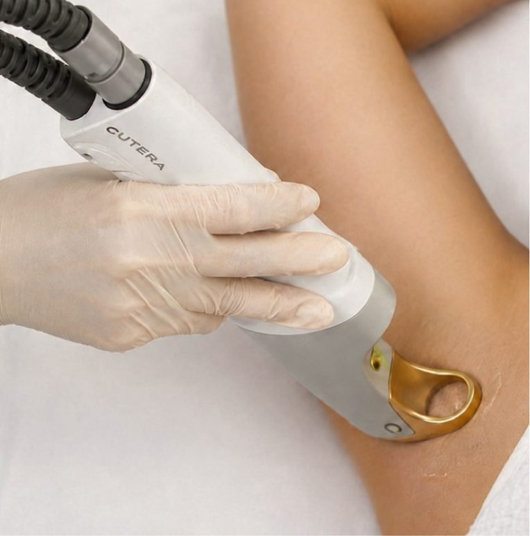 Laser Hair Removal