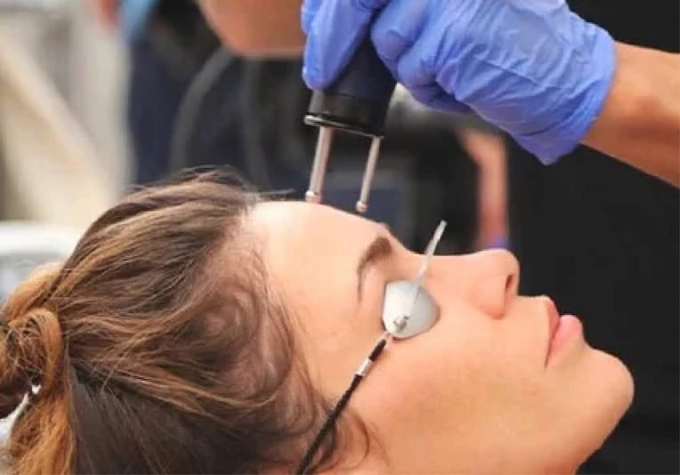 Laser Skin Resurfacing